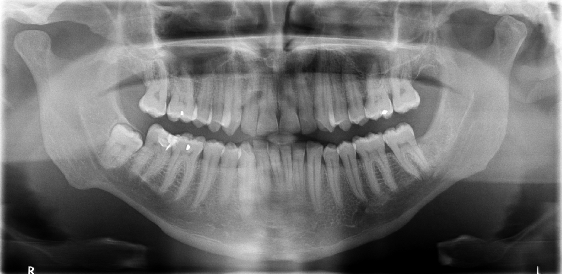 dental x-ray